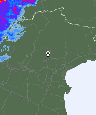Radar