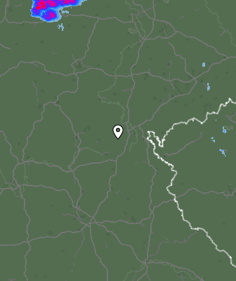 Radar
