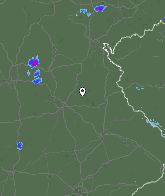 Radar