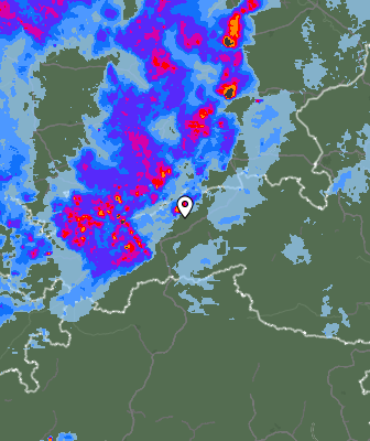 Radar