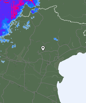 Radar