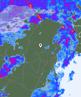 Radar