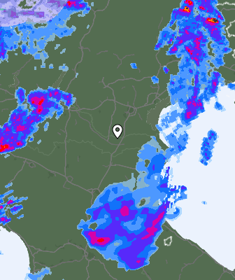 Radar