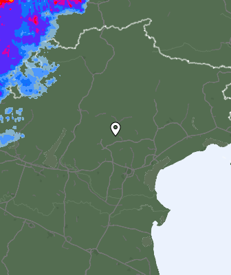 Radar