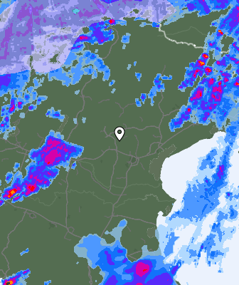 Radar
