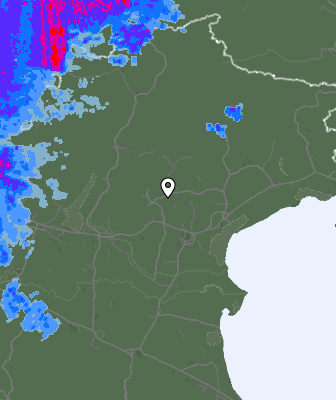 Radar