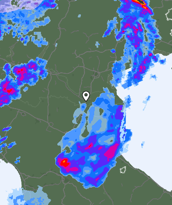 Radar