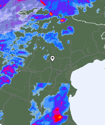 Radar