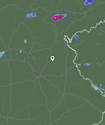 Radar