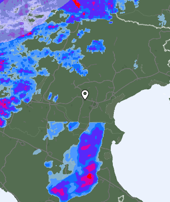 Radar