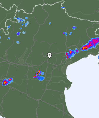 Radar