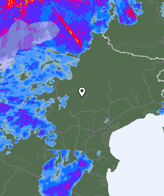 Radar