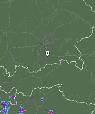 Radar