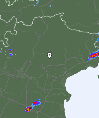 Radar