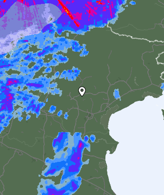 Radar