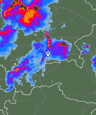 Radar