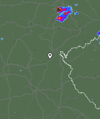 Radar