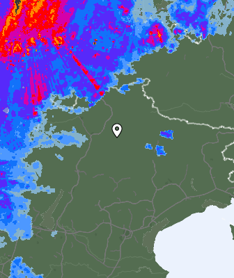 Radar