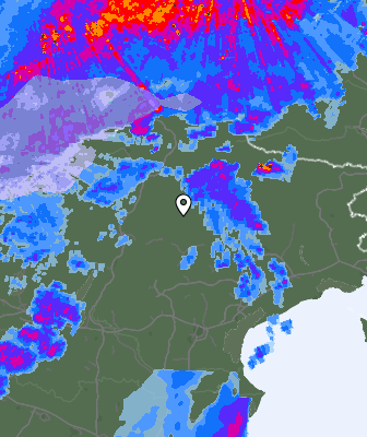 Radar