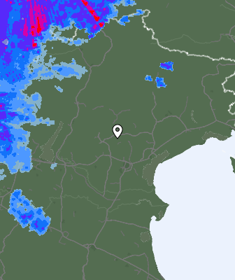 Radar
