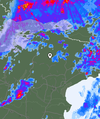 Radar