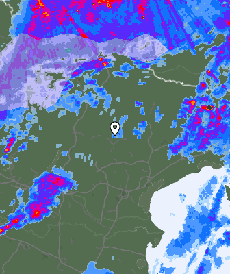 Radar