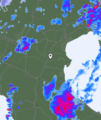 Radar