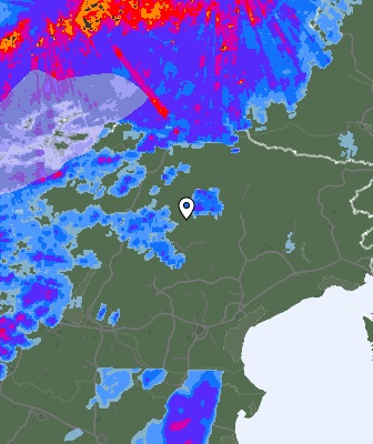 Radar