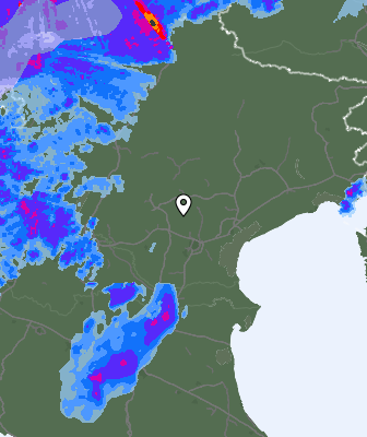 Radar