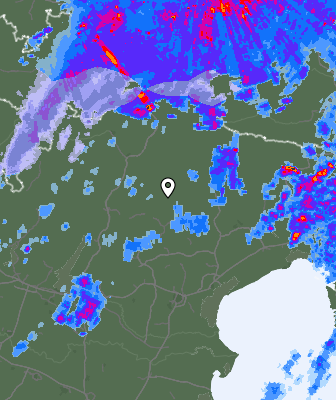 Radar