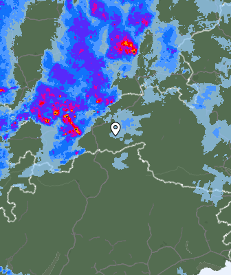 Radar