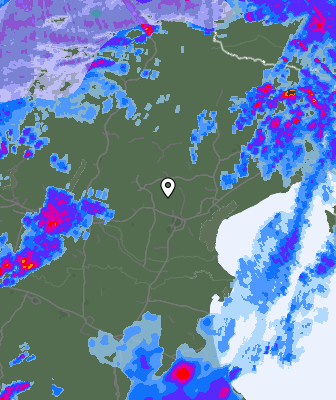 Radar