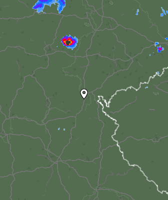 Radar