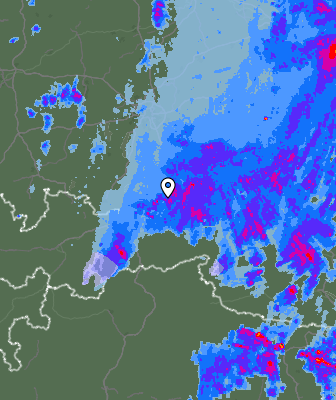 Radar