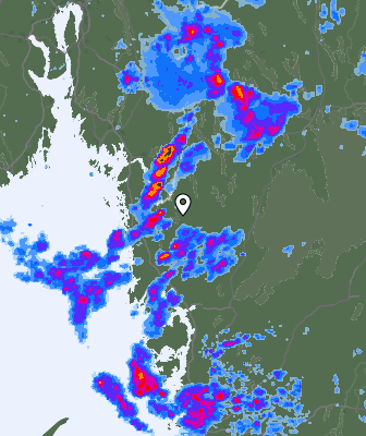 Radar