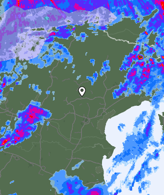 Radar