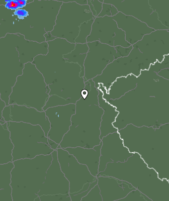 Radar