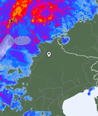Radar