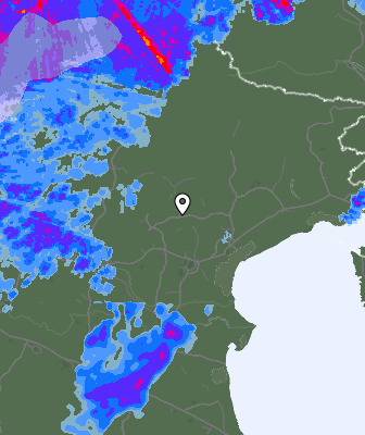 Radar