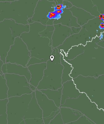 Radar
