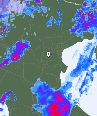 Radar