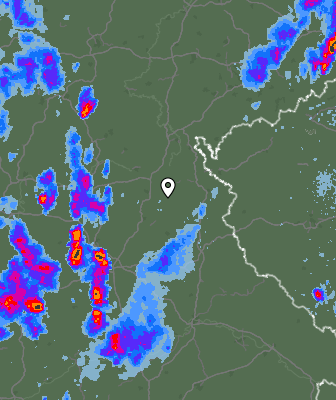 Radar