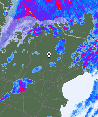 Radar