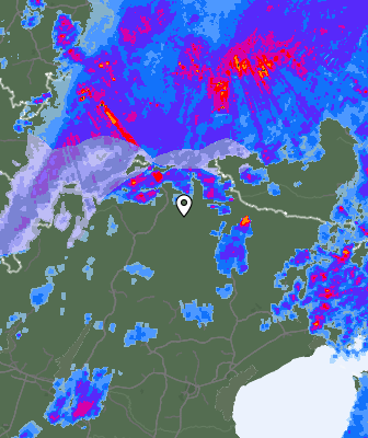 Radar
