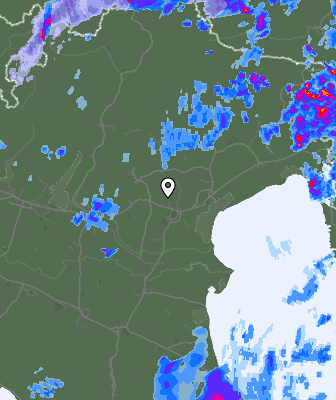 Radar