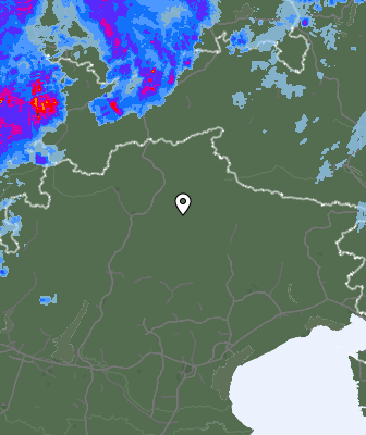 Radar