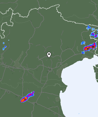 Radar