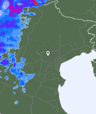 Radar