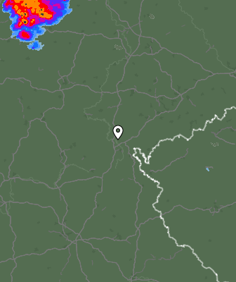 Radar