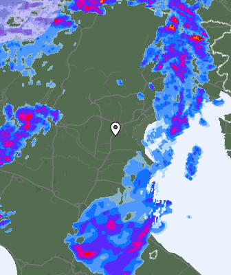 Radar